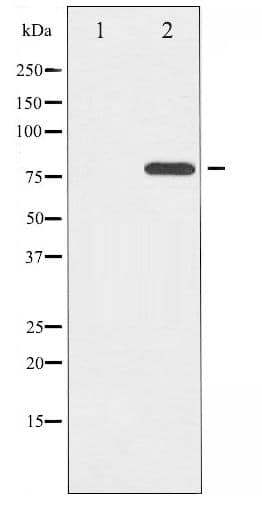ETK / BMX Antibody (phospho-Tyr566)