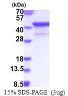 Human SIRPA / CD172a Protein (Recombinant His)