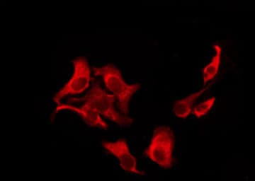 SLC52A2 / GPR172A / PAR1 Antibody