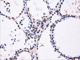 ATP5B / ATP Synthase Beta Antibody (clone OTI4E5)