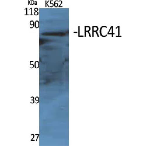 LRRC41 Antibody (360-440 aa, Internal)