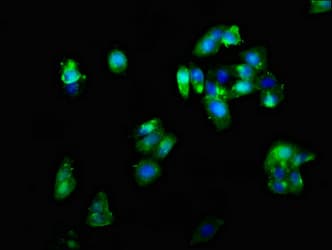 CRHR2 / CRF2 Receptor Antibody