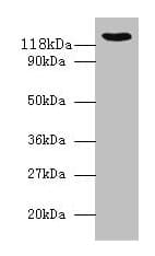 IHC-plus™ Polyclonal Rabbit anti-Human VCL / Vinculin Antibody (aa 2-235, IHC, WB)