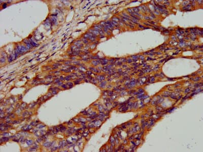 Polyclonal Rabbit anti-Human HEXB Antibody (IHC)