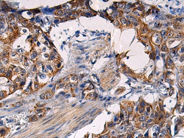 RITA1 / C12orf52 Antibody