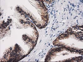 CTNNB1 / Beta Catenin Antibody (clone OTI9H2, Carrier-free)