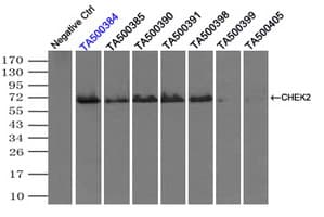 CHEK2 / CHK2 Antibody (clone OTI2H5)