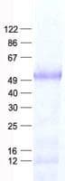 Human LHX2 Protein (Recombinant His, N-Terminal)