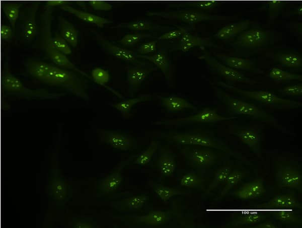 IHC-plus™ CIRP / CIRBP Antibody (clone 1C9)