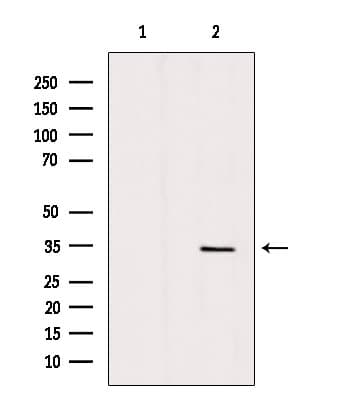 Polyclonal Rabbit anti-Human ANT2 / SLC25A5 Antibody (WB)