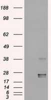 OSM / Oncostatin M Antibody (clone OTI2B6)