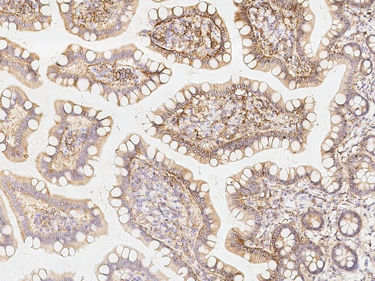 Monoclonal Mouse anti-Human CD98 Antibody (clone 04, Preservative Free, IHC)
