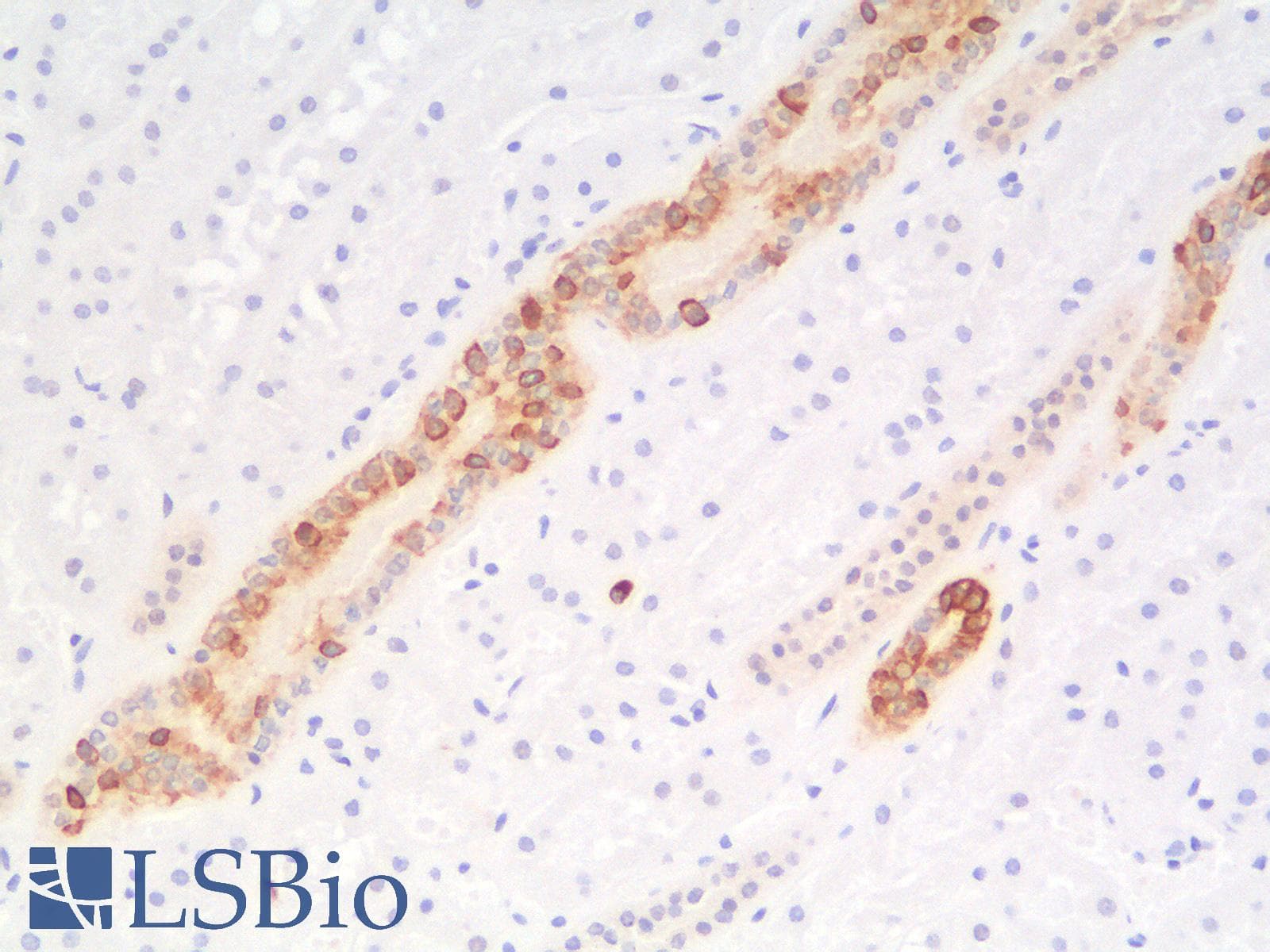 PathPlus™ KRT7 / CK7 / Cytokeratin 7 Antibody (clone rOV-TL12/30)