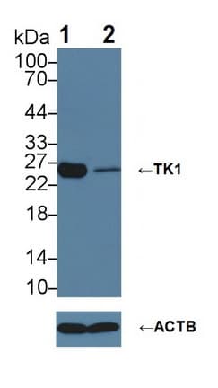 TK1 / TK / Thymidine Kinase Antibody (aa2-234)