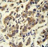 MBD3L3 Antibody (aa156-184)
