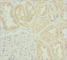 TNS3 / Tensin 3 Antibody