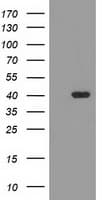 TBC1D21 Antibody (clone OTI1A8)
