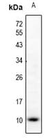 Polyclonal Rabbit anti-Human CCL5 / RANTES Antibody (IHC, WB)