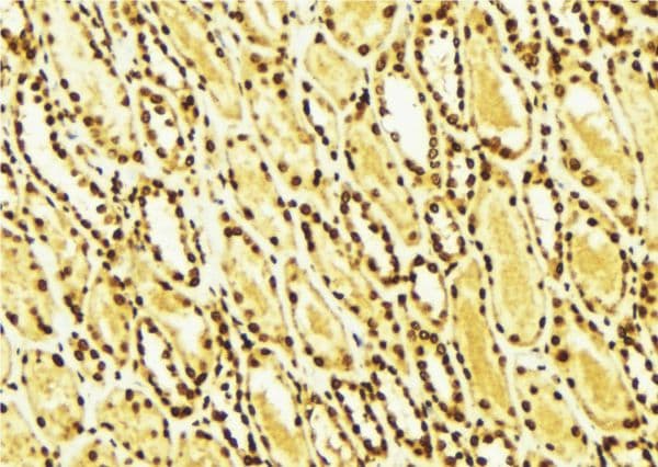 ERBB2 / HER2 Antibody