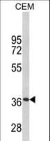 MPZ / P0 Antibody (aa186-215)
