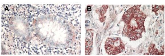 AKT1 + AKT2 + AKT3 Antibody (aa460-480)
