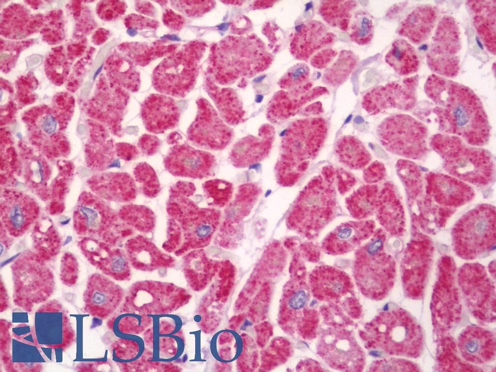 IHC-plus™ Polyclonal Rabbit anti-Human CHPF / CHSY2 Antibody (aa631-680, IHC, IF, WB)
