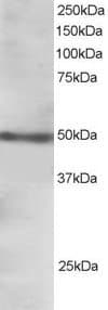 IHC-plus™ FOXL2 Antibody (aa364-376)