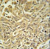 Polyclonal Rabbit anti-Human GSTK1 Antibody (aa93-120, IHC, WB)