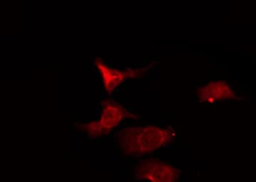 OR6K2 Antibody
