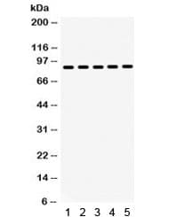 Polyclonal Rabbit anti-Human HSP90 Beta Antibody (IHC, WB)