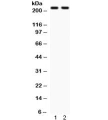 GRIN2B / NMDAR2B / NR2B Antibody