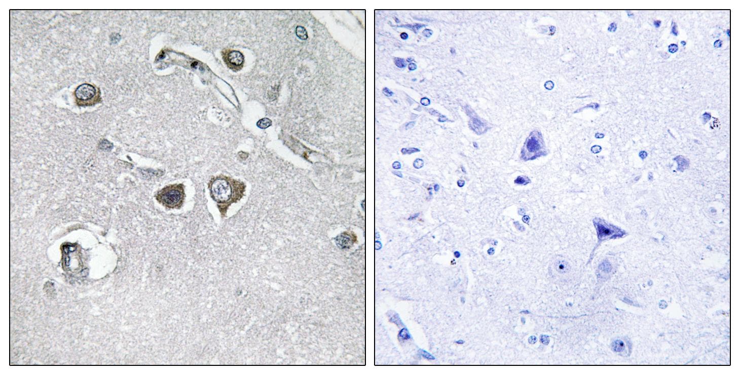 COL11A2 / Collagen XI Antibody