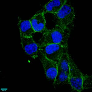 Recombinant Monoclonal Rabbit anti-Human ADGRE5 / CD97 Antibody (IHC, IF)