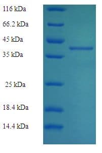 Human RAB27B Protein (Recombinant His-SUMO)