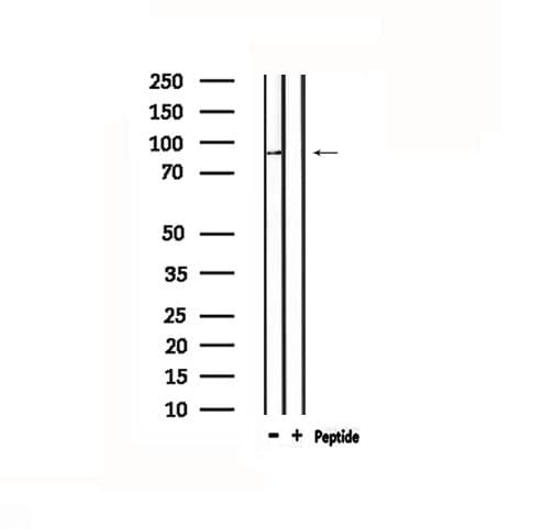 Polyclonal Rabbit anti-Human TOP1 / Topoisomerase I Antibody (IF, WB)