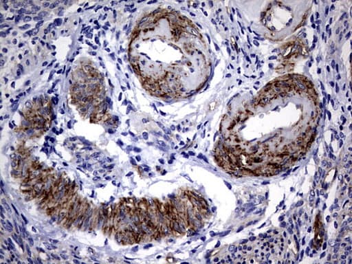 MCAM / CD146 Antibody (clone OTI5C4)