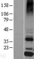 SSR4 Protein (Over-Expression Lysate Myc-DDK (Flag))