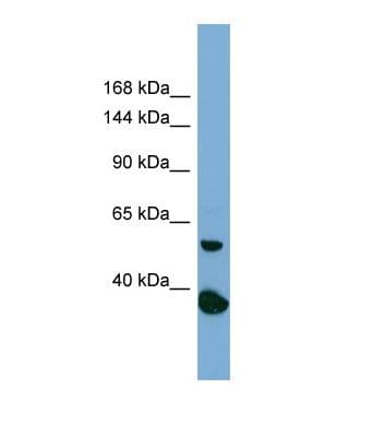 RAD50 Antibody (N-Terminus)