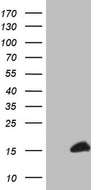 S100A1 / S100-A1 Antibody (clone OTI2A4)