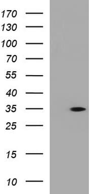 ANKRD49 Antibody (clone OTI3E4)