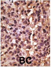 Polyclonal Rabbit anti-Human NIP3 / BNIP3 Antibody (aa152-187, IHC, IF, WB)