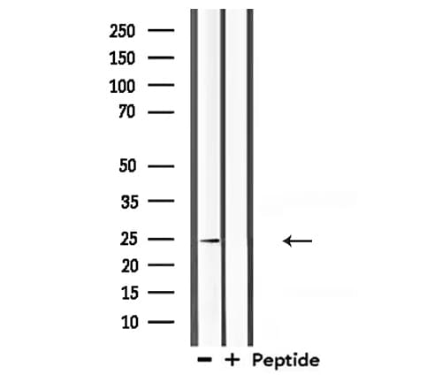 CLDN10 / Claudin 10 Antibody