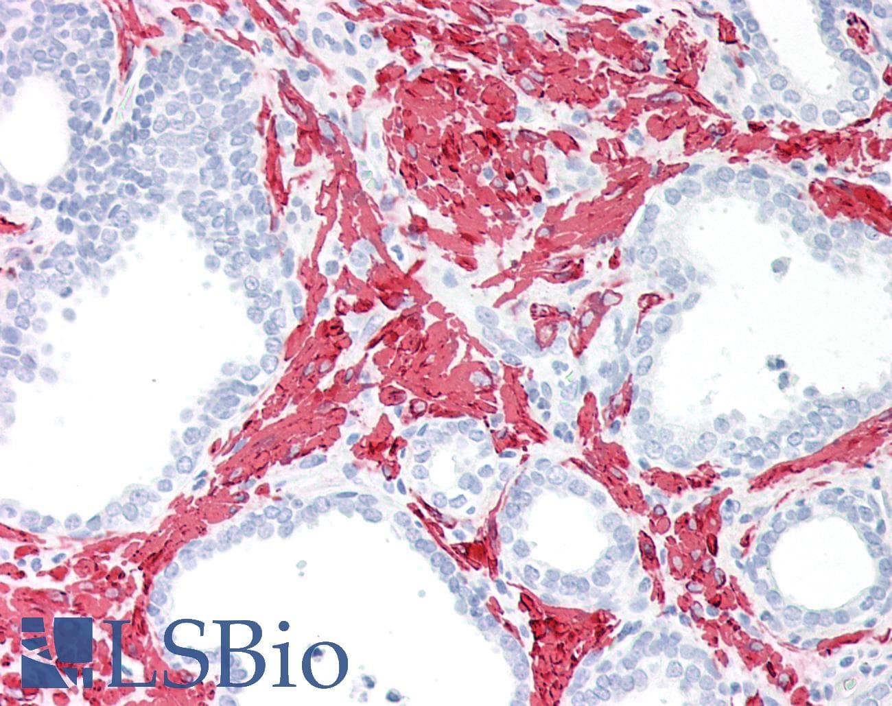 PathPlus™ Monoclonal Mouse anti-Human Muscle Actin Antibody (IHC)