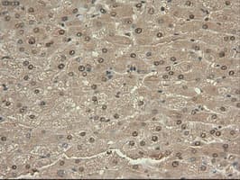 Monoclonal Mouse anti-Human MYC / c-Myc Antibody (clone OTI1A6, IHC, IF, WB)