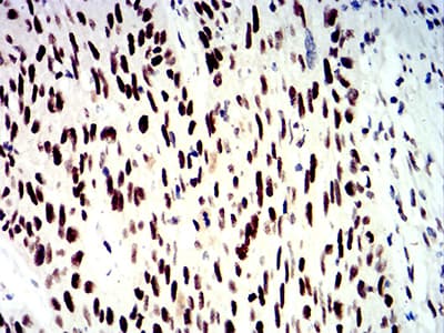 Monoclonal Mouse anti-Human SMARCA1 / SWI Antibody (clone 2H7B9, IHC, WB)