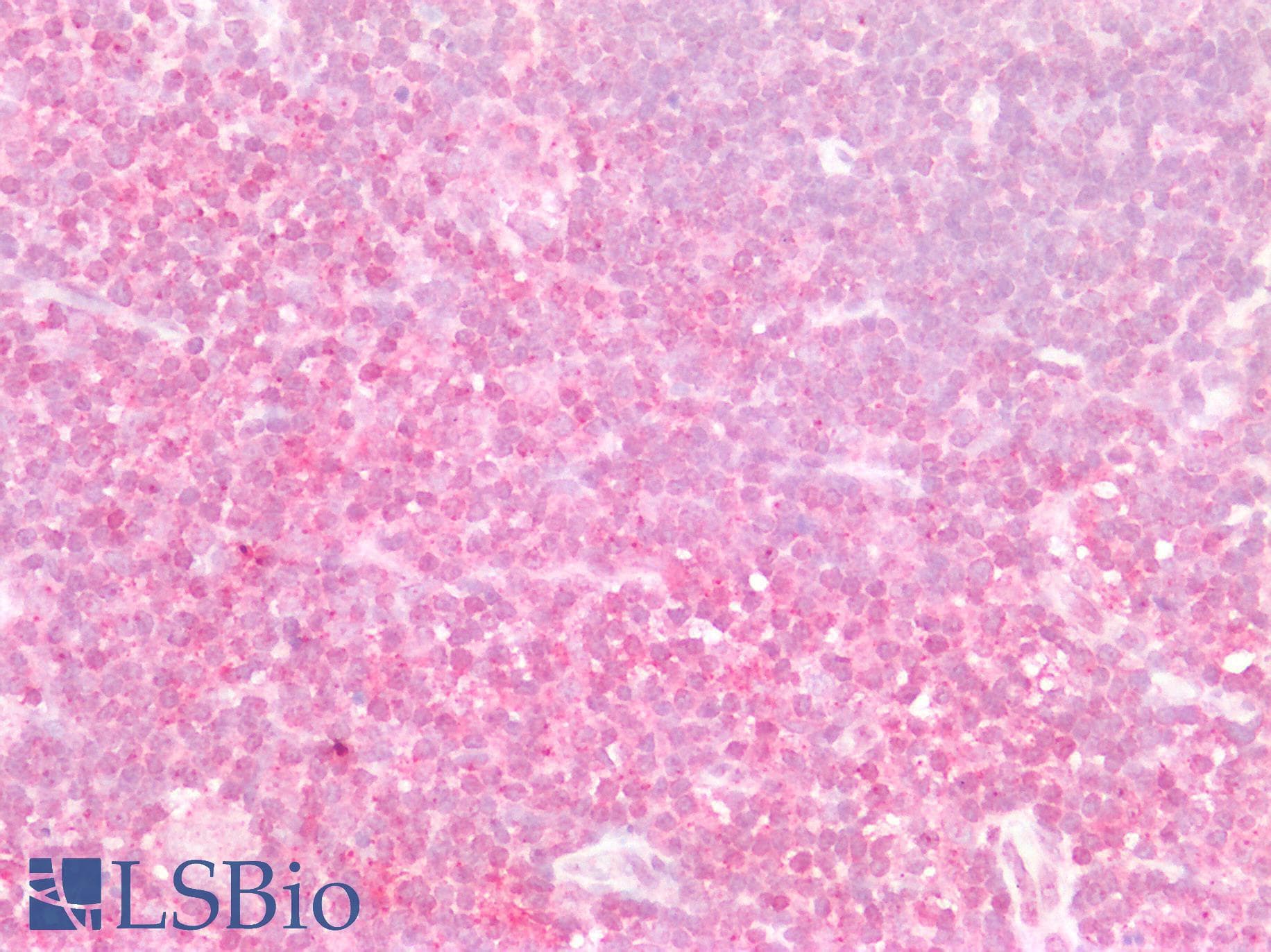 PathPlus™ IGF1 Antibody