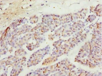 MYO5C Antibody