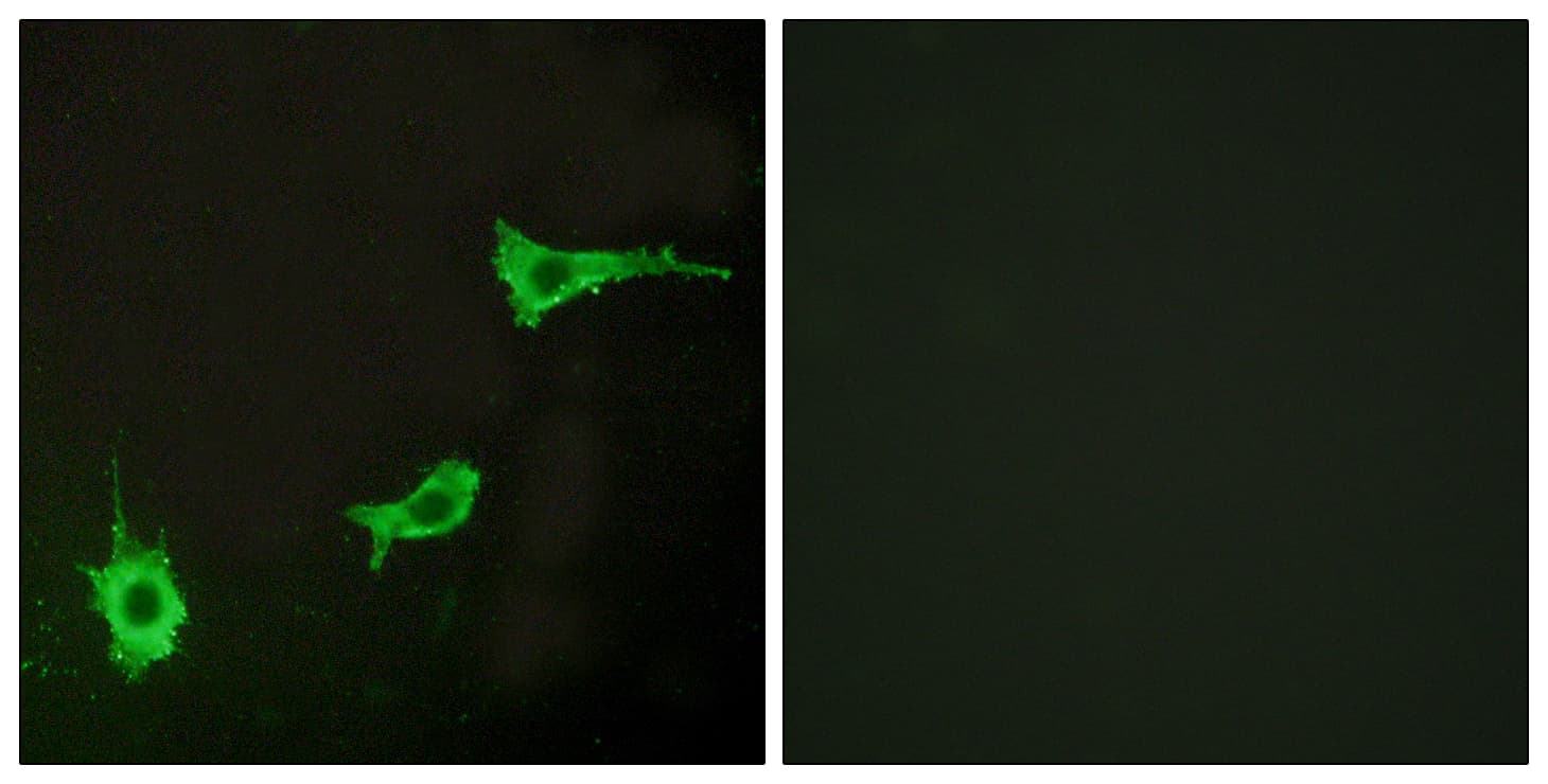 IHC-plus™ EDNRA / Endothelin A Receptor Antibody (aa378-427)