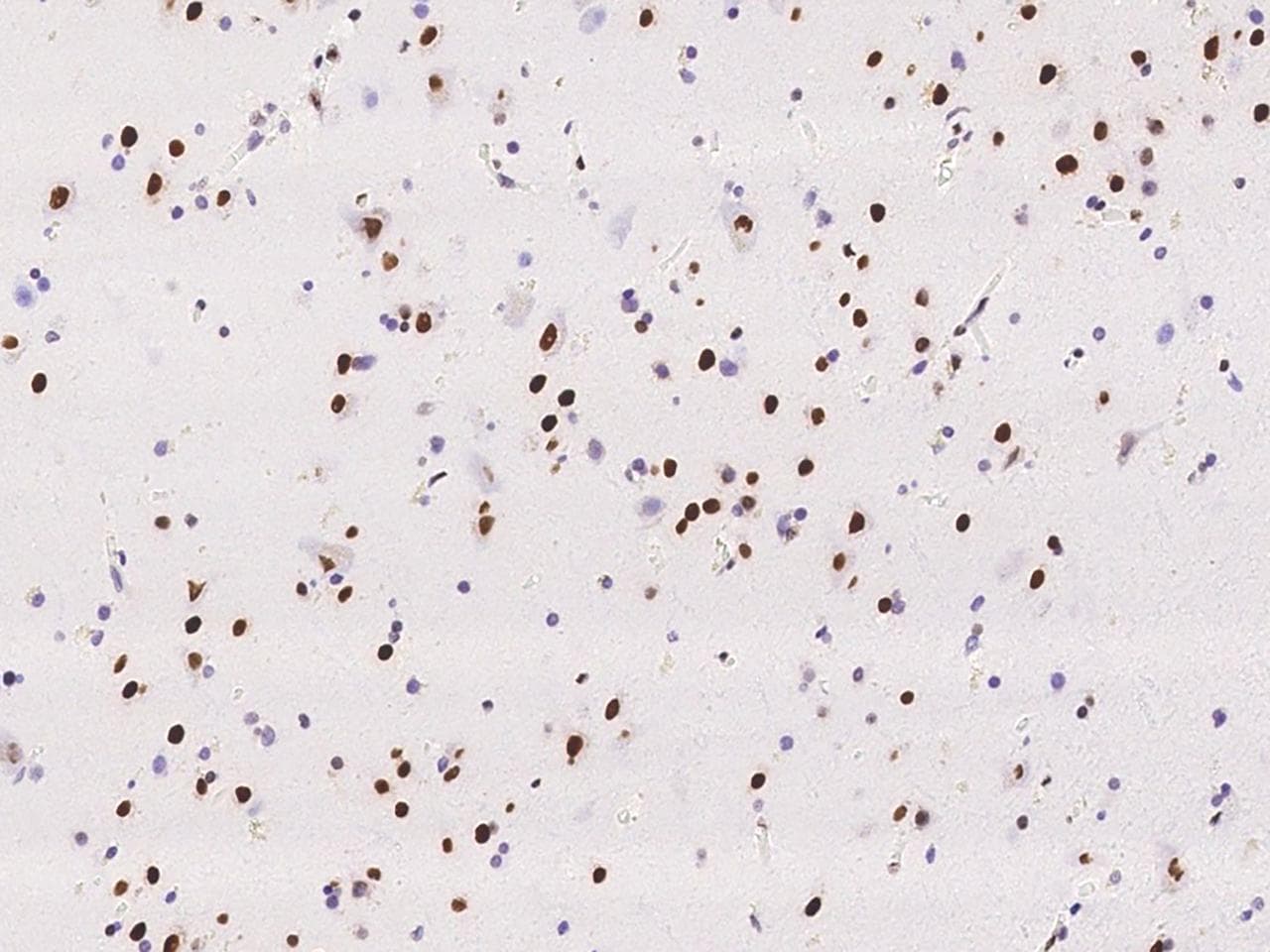 RALYL Antibody