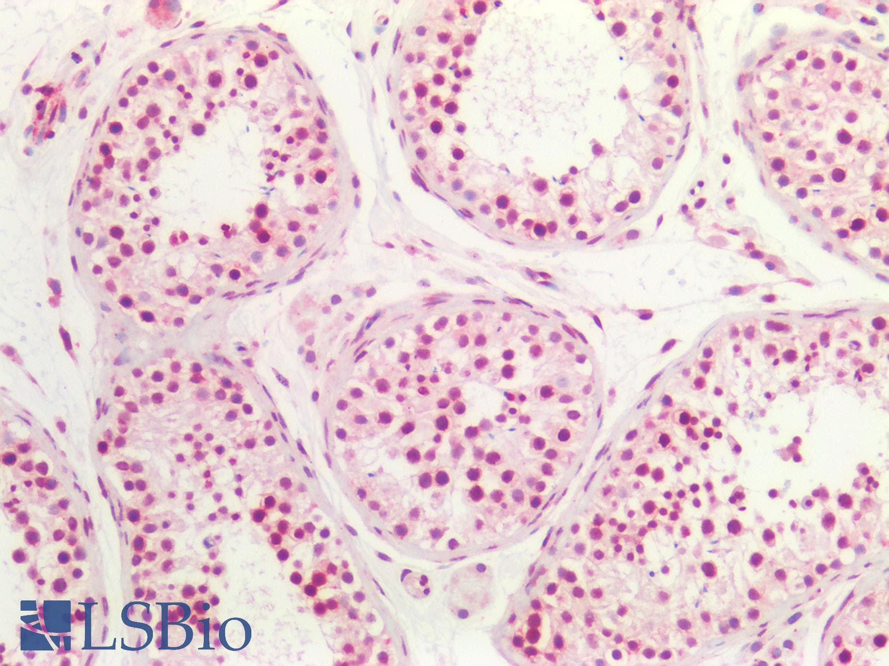 PathPlus™ Polyclonal Rabbit anti-Human FOXP1 Antibody (aa650-677, IHC, WB)